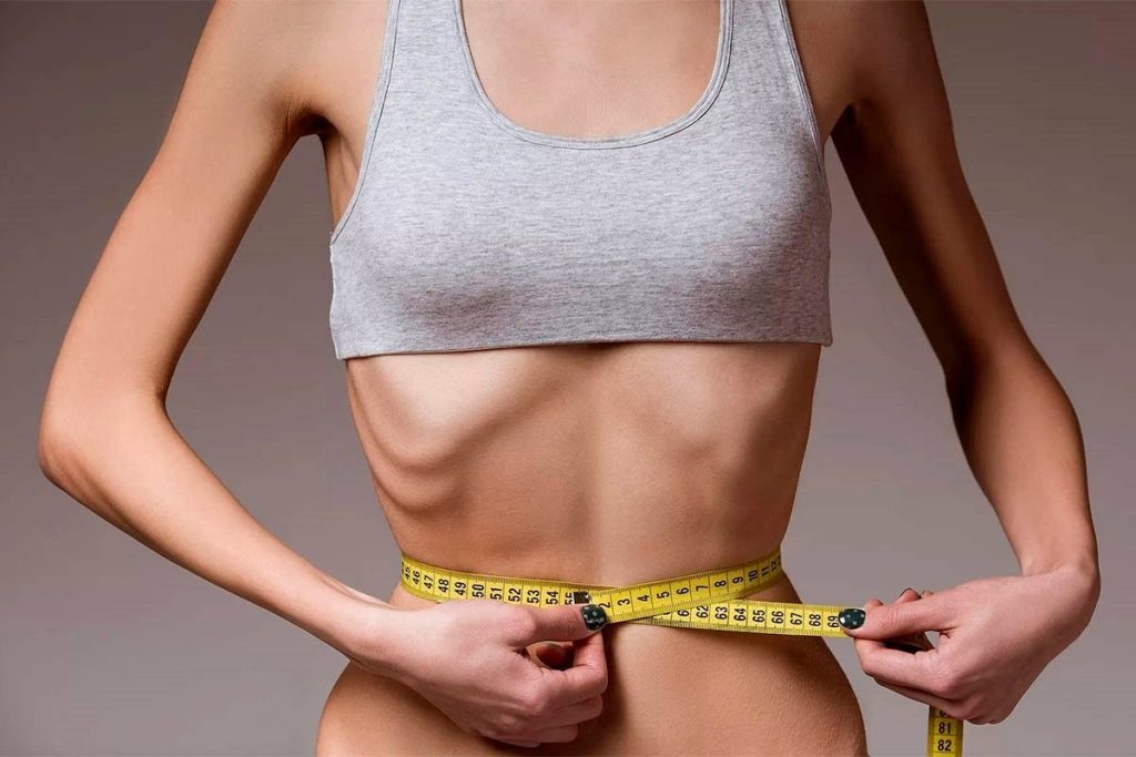 Diferențe între anorexie și bulimie