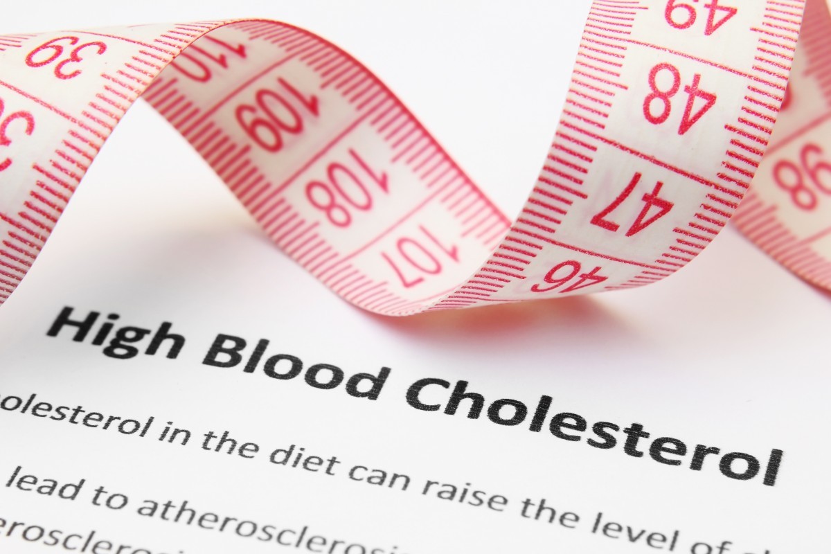 5 sfaturi să controlezi colesterolul mărit