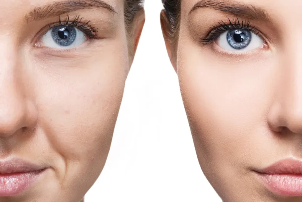 Cum sa ai un ten perfect. La ce trebuie sa fii atenta Cum sa ai un ten perfect. La ce trebuie sa fii atenta