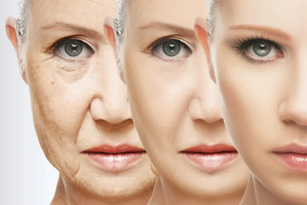 Cum sa cresti natural nivelul de acid hialuronic din organism Cum sa cresti natural nivelul de acid hialuronic din organism