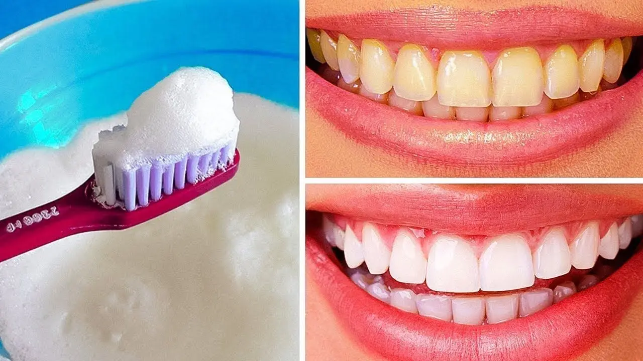 5 moduri naturale de a va albi dintii acasa